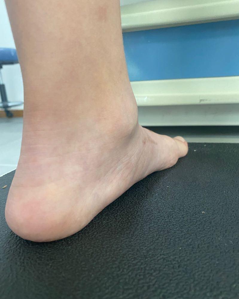 pie plano limitacion 7