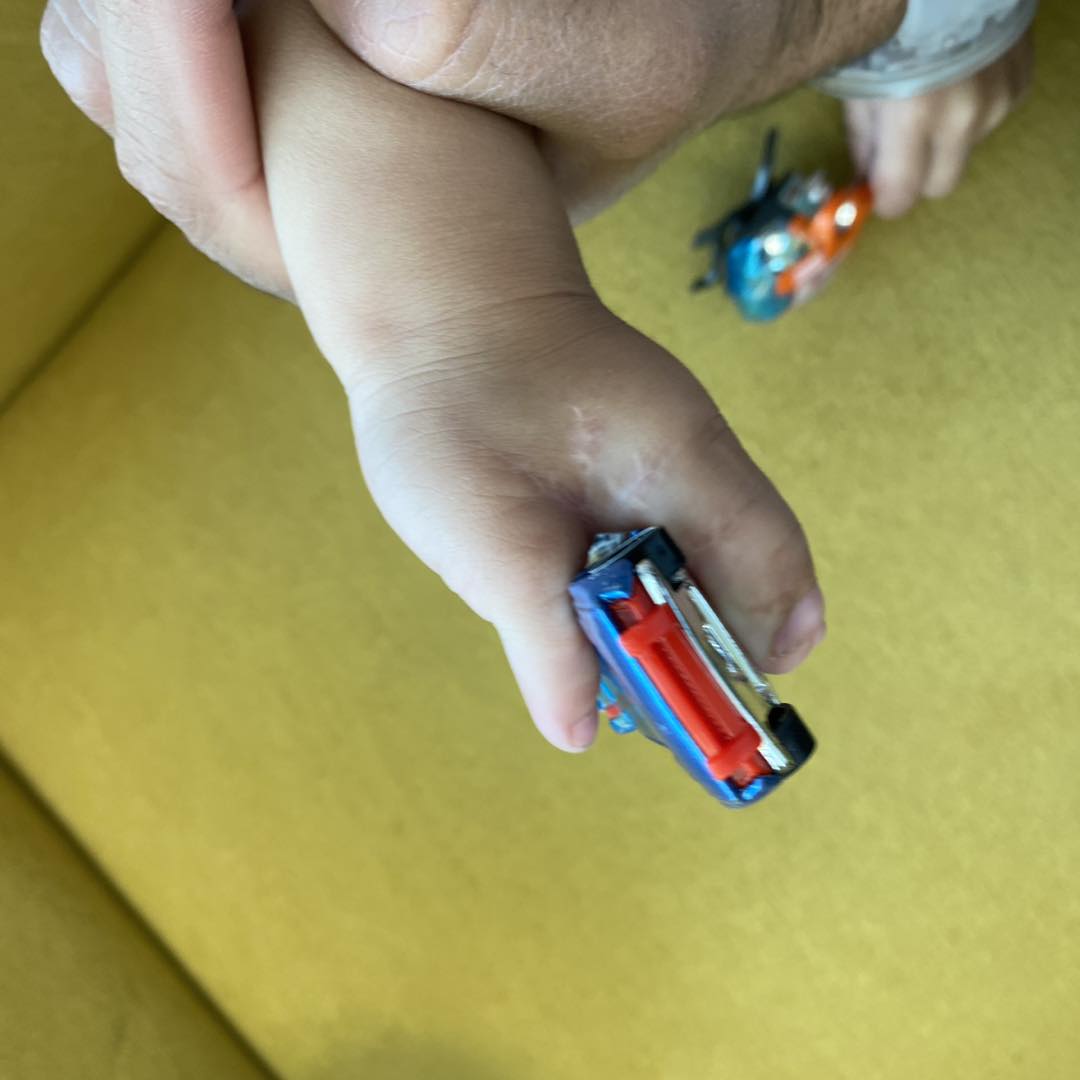 reconstrucción mano 6